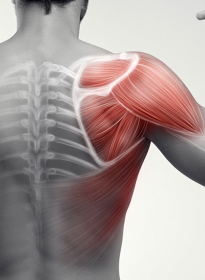 Case Study Image